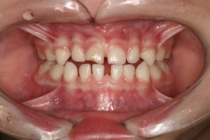 IMG_8285-1-300x200
